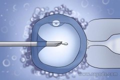 <b>识别质量差或高风险的IVF实验室</b>